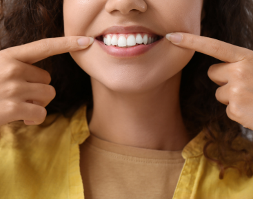 dental veneers at golden grove dental placerville