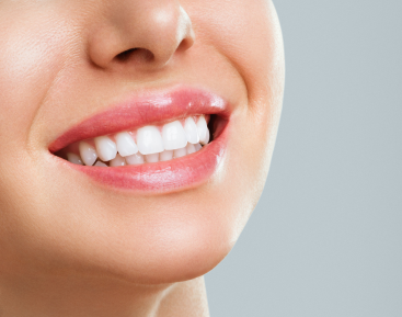 teeth whitening at golden grove dental placerville