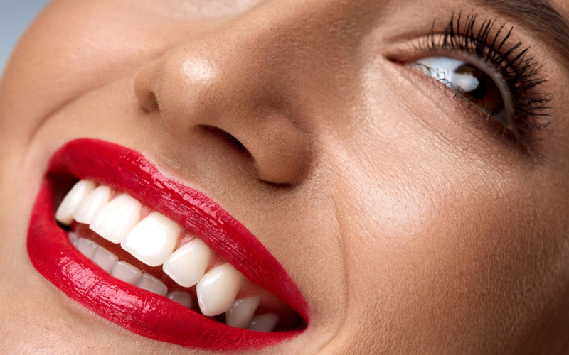 Does age matter for teeth whitening