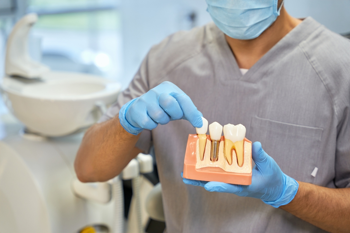 dental implants in Placerville