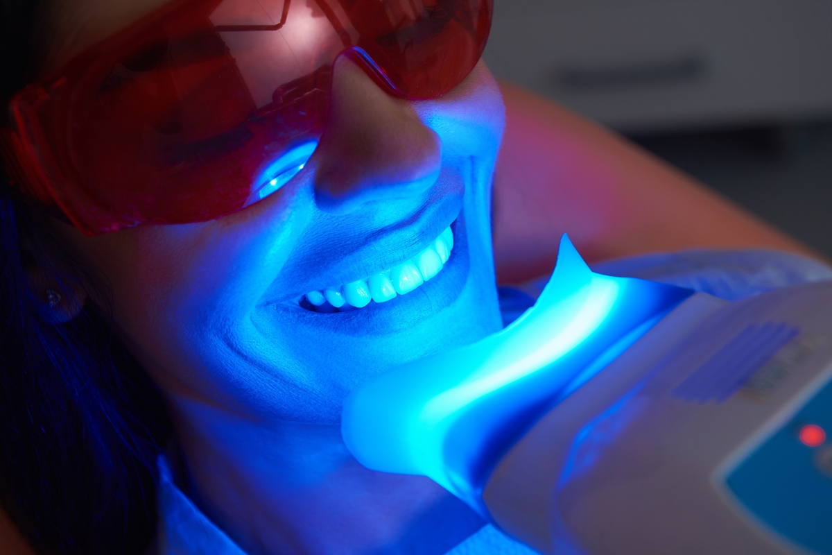 Teeth Whitening Placerville CA